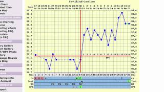 Triphasic Ovulation Chart - Video Interpretation