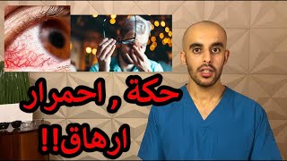 جفاف العين اسباب و علاج ( dry eye )