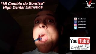 Mi Cambio de Sonrisa en High Dental Esthetics - Vlog #90
