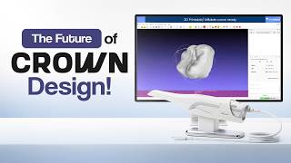 Digital Crown Design Workflow | Waldent BLZ IntraVue 900 AI Intraoral Scanner | DentalKart