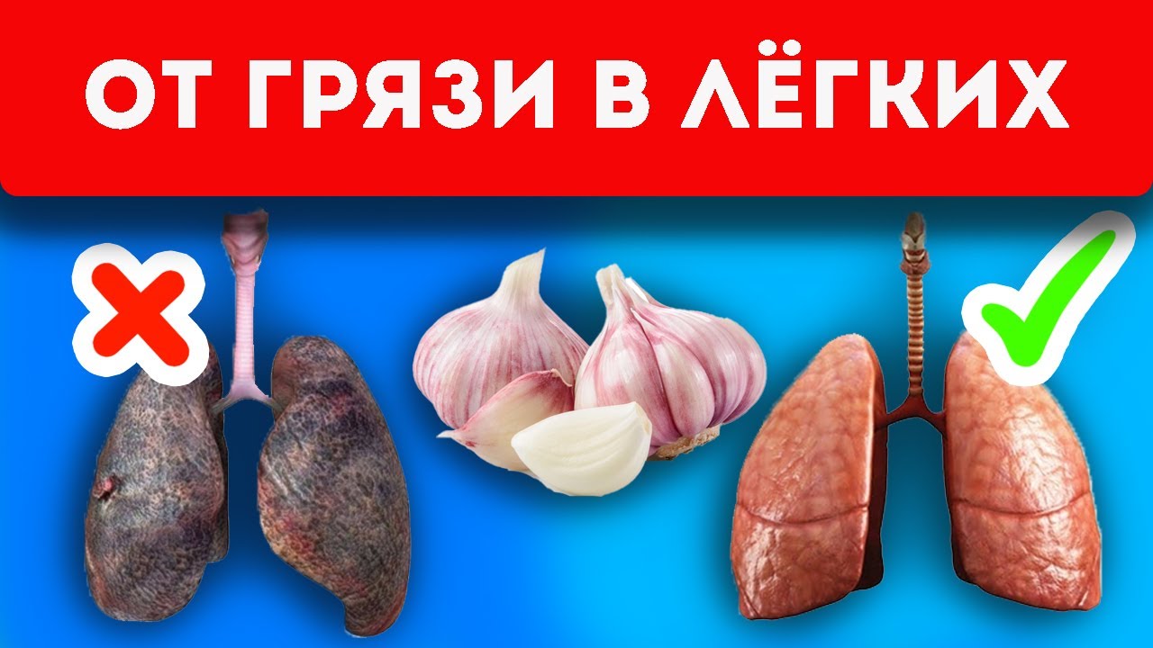 У соседа вышла черная мокрота после 3 простых упражнений