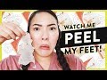 Watch Me Peel My Feet 😳 | GBT | soothingsista