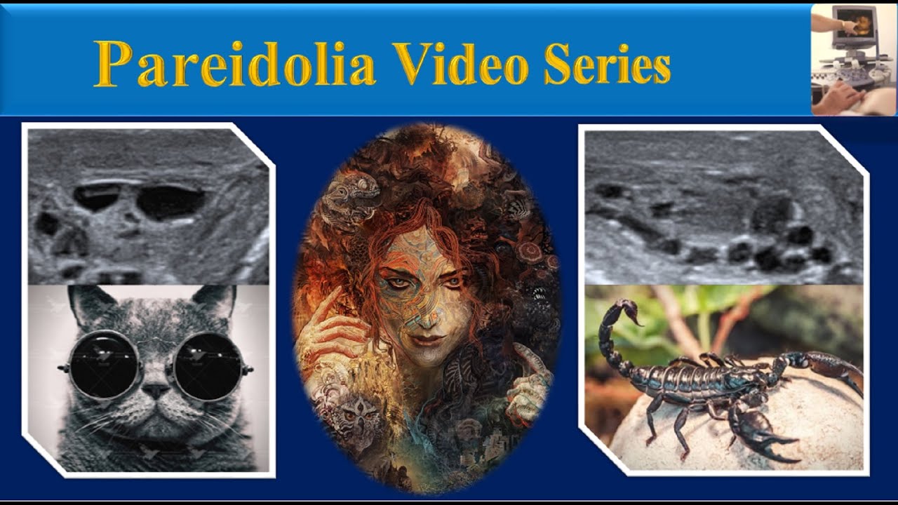 Pareidolia, Incorrect perception of radiologic images