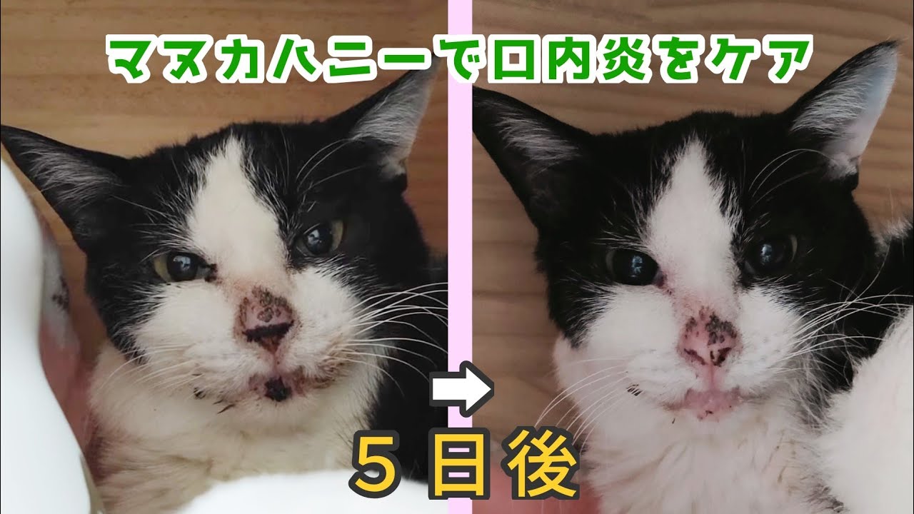 マヌカ ハニー 口内炎
