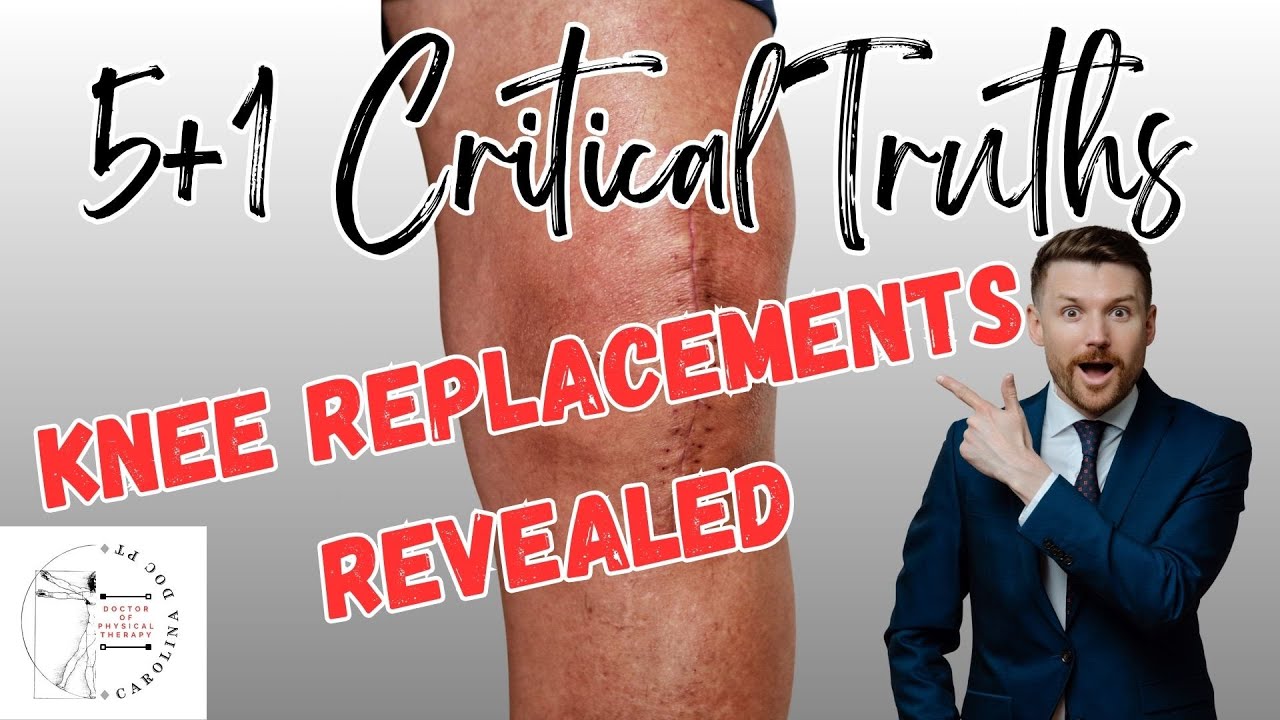 Knee replacement? You NEED to see this!! - YouTube