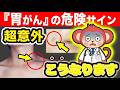 警告!胃がんは胃が痛いだけじゃない!胃がんのサインを無視してはいけない