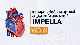 Introducing Impella for the first time in Kerala  - Amrita Hospitals