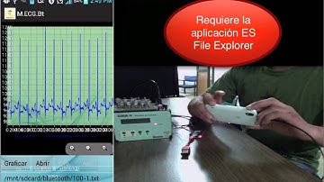 Monitor ECG Bluetooth Android