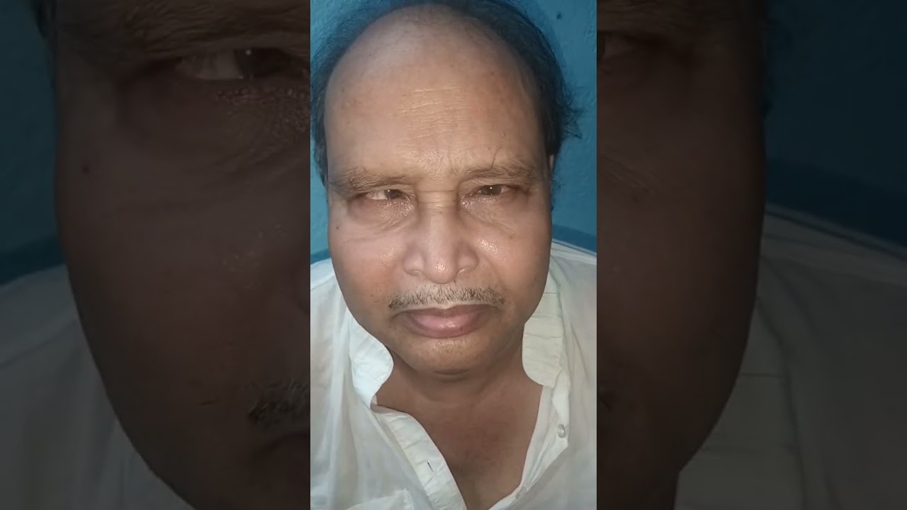 Be aware from diabetes #youtubeshorts #doctor #medicosstuff #mbbsprivatecolleges #medicalcollege Be aware from diabetes #youtubeshorts #doctor #medicosstuff #mbbsprivatecolleges #medicalcollege