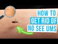 Effective Tips to Eliminate No-See-Ums ๐ฆ