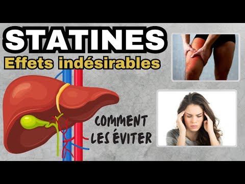 Vidéo: Les statines provoquent-elles une capsulite ?