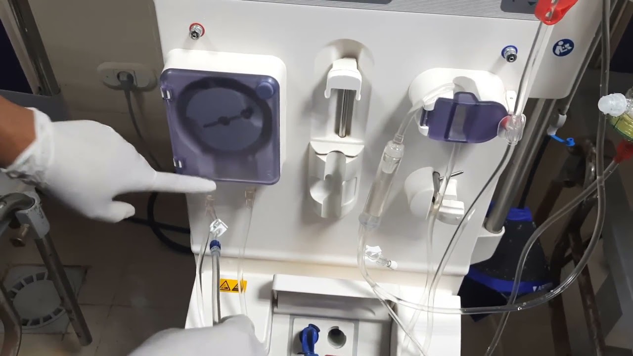 اول مرة اركب مكنة الغسيل الكلوى ...عملى