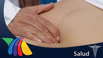 ¿Qué cánceres presentan hinchazón abdominal como síntoma?