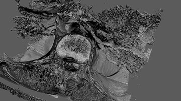 Converting MRI Scan Data to a 3D Mesh Using Python, OpenCV, and skimage