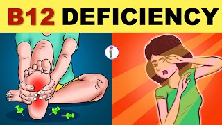 Vitamin B12 Deficiency Symptoms | B12 Deficiency | Vitamin B12 - All You Need to Know