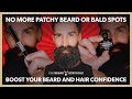 Thin balding hair  patchy beard  bald spots  quick  easy fix  baldrs arrow from tbs
