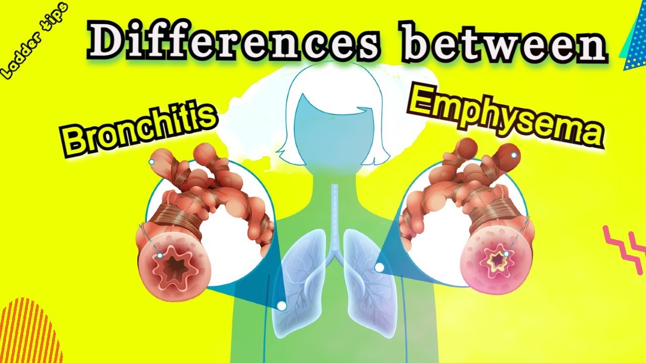 Differences between Bronchitis And Emphysema | Biology | Ladder Tips ...