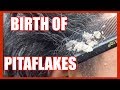 BEST OF PITAFLAKES VIDEO MONTAGE | APRIL 2018 | EXTREME DANDRUFF | SEBORRHEIC DERMATITIS