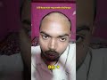 Day 4 | 180 days hair regrowth challenge #hairfallsolution #regrowthofhairs #inspiration