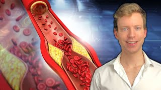 How To CORRECTLY Lower Cholesterol & Why