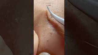 Plucking Beard close up #beardcare #foryou #beard #asmr