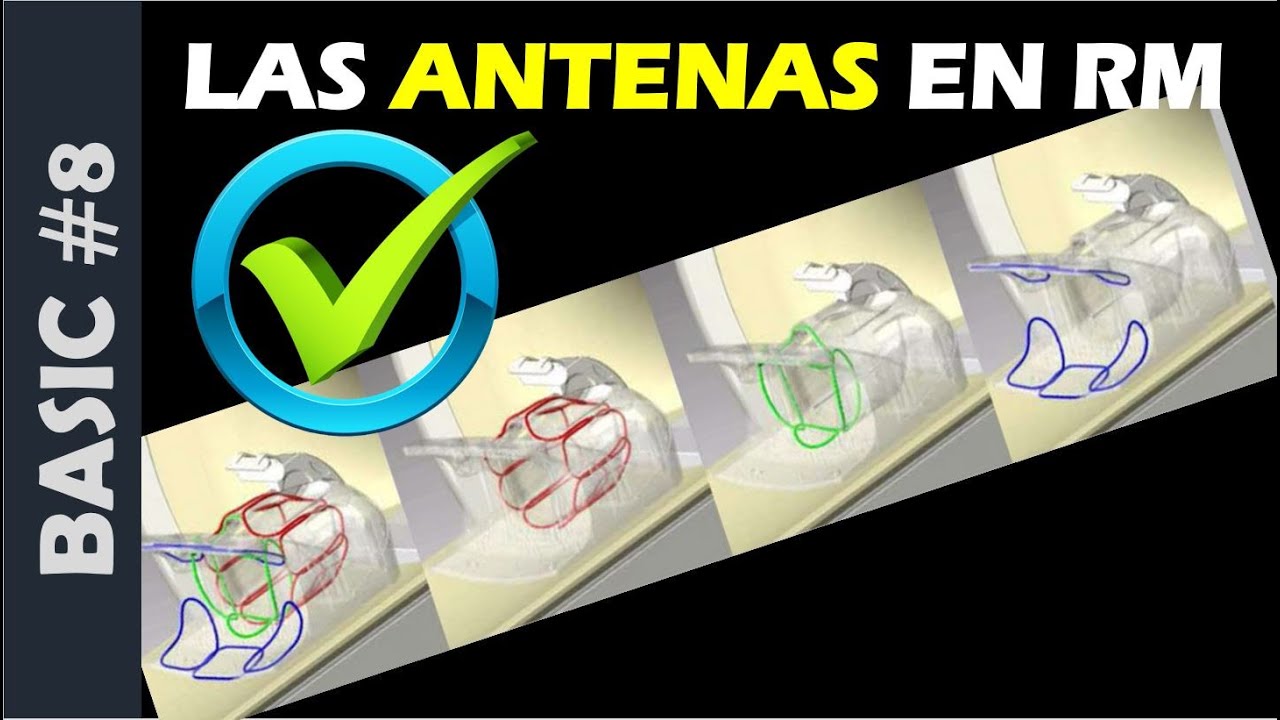 🚀 Las Bobinas en Resonancia Magnética: qué son y para qué sirven