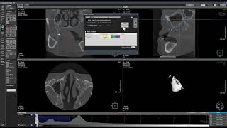 3D sinus