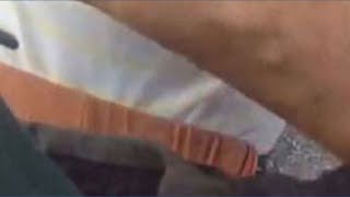 Florida deputy saves choking baby