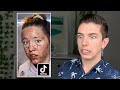 Specialist Reacts to Skin Care TikTok *FAILS*