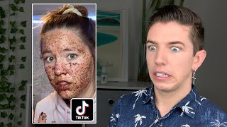 Specialist Reacts to Skin Care TikTok *FAILS*