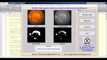 Matlab Code for Diabetic Retinopathy Detection Using CNN