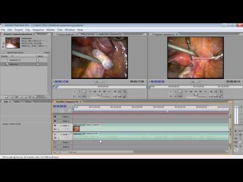 Laparoscopic Movie Making