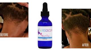 Miracle Drops Saç Serumu Nedir? Nasıl Kullanılır? Kullanıcı Yorumları