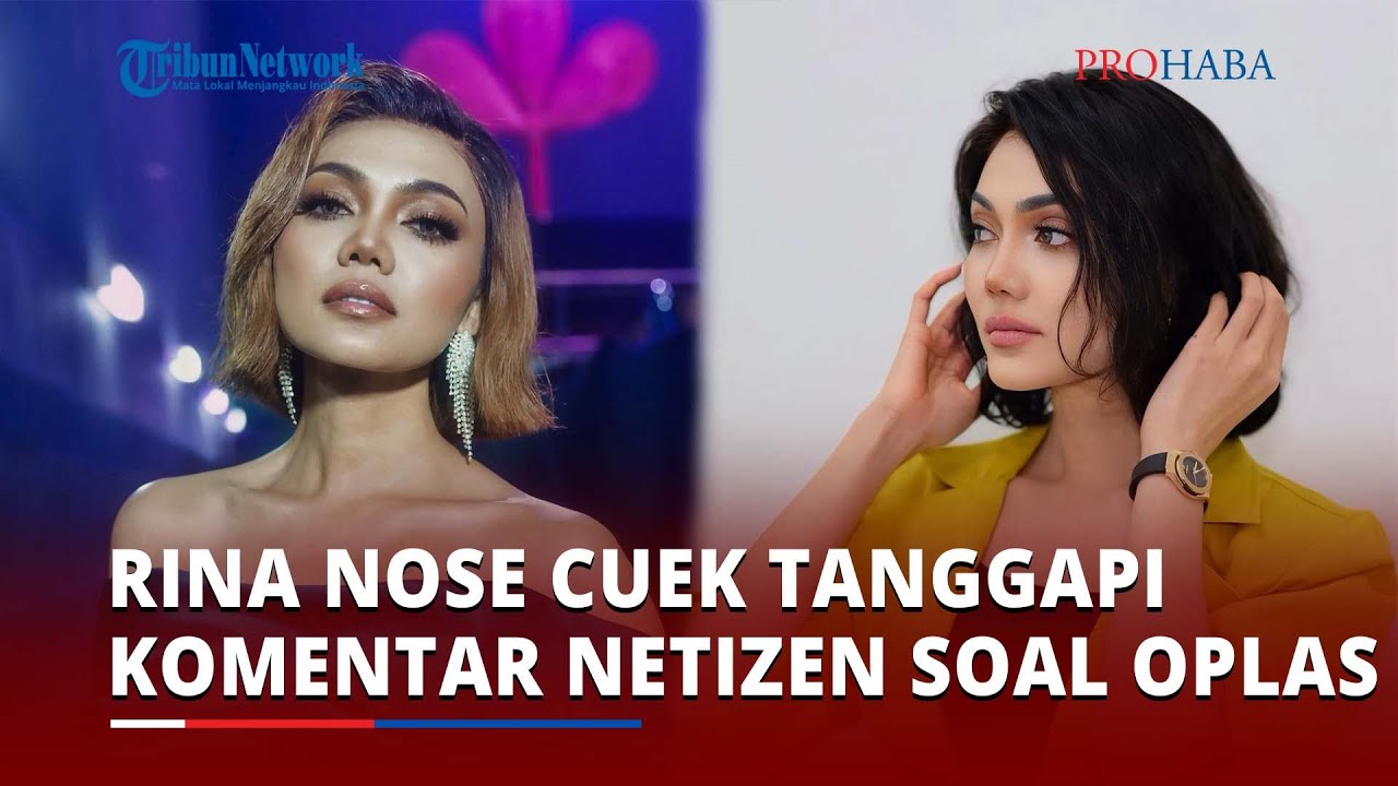 Rina Nose Cuek Tanggapi Komentar Warganet yang Melarang Dirinya Operasi Plastik