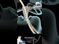 Intubation in less than 20 seconds #mbbs #surgery #skincare