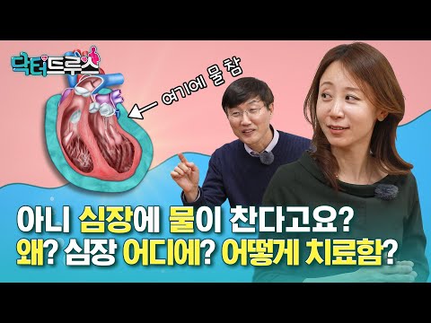 건강검진에서 ‘심장에 물이 찼다’고 하면 이렇게 하세요 [닥터트루스] 슬기로운 심장생활 30