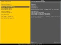 ESXi Post Install Part-8 Console Troubleshooting