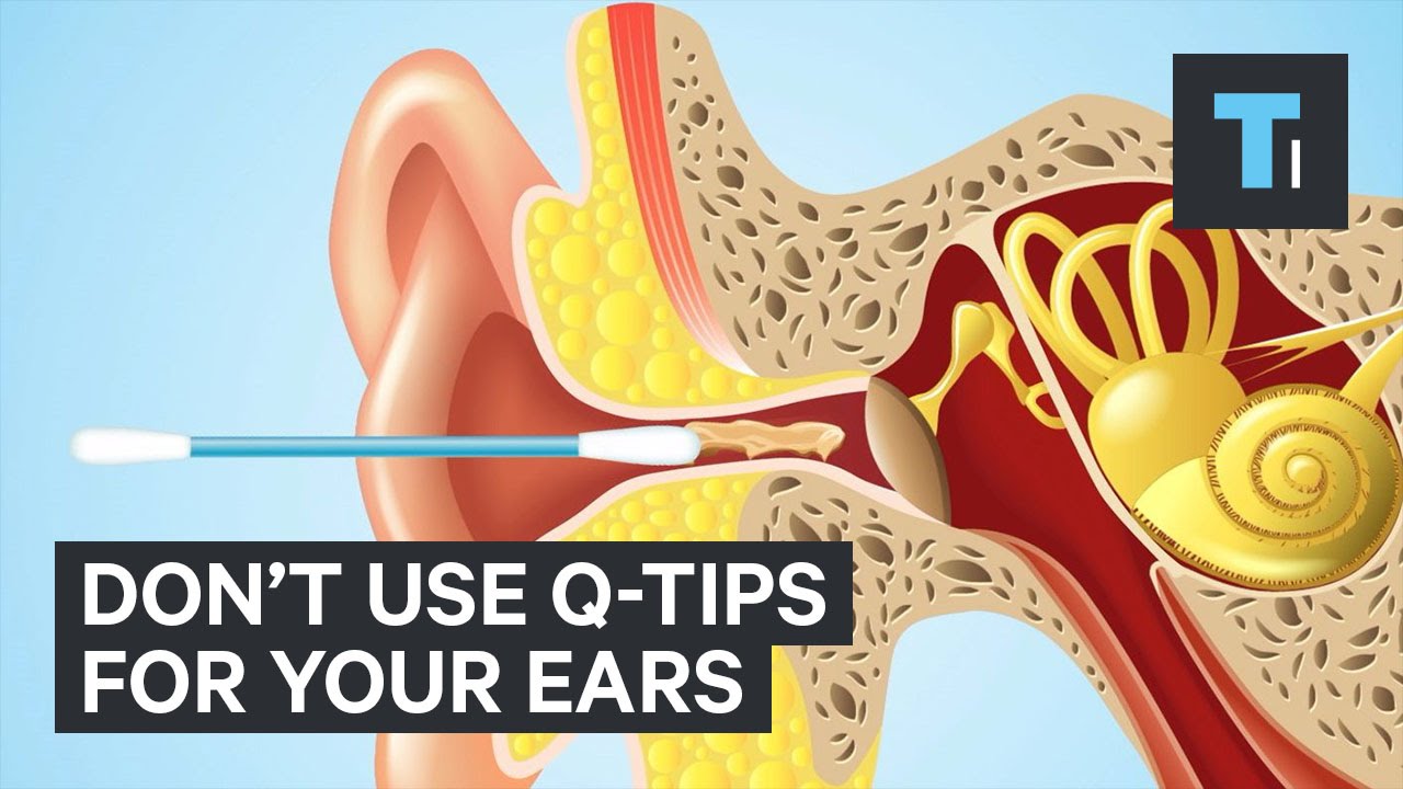 Kommandør Bedøvelsesmiddel violin Don't use Q-tips for your ears - YouTube