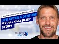 All on 4 plus after denture  patient story