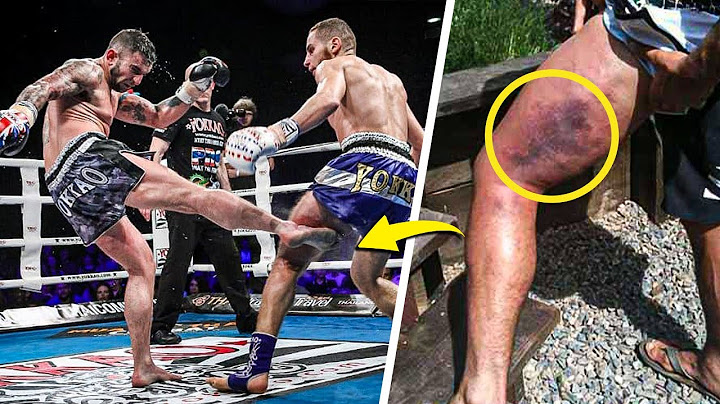 Most Brutal Low Kick KO's in Combat Sports