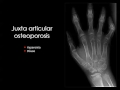 Imaging of Arthritis I Aug 2014   Dr Mamdouh Mahfouz In Arabic