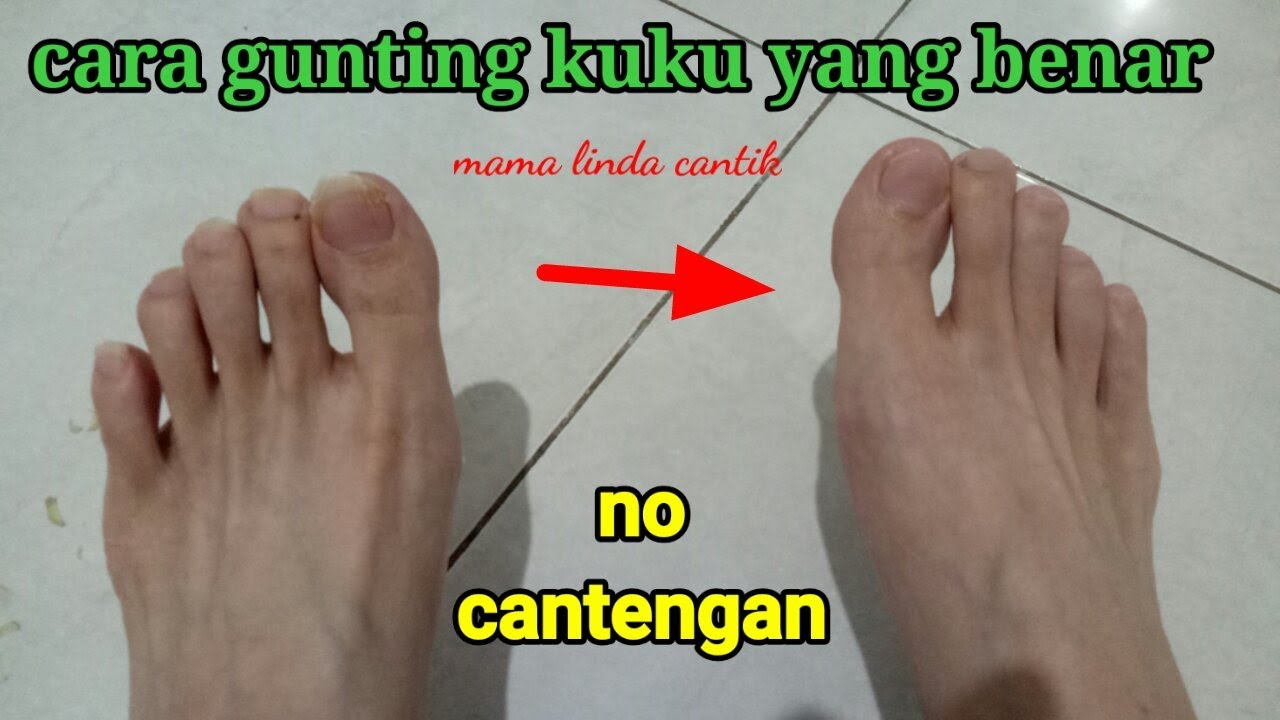 cara memotong kuku kaki agar tidak cantengan. cara menggunting kuku