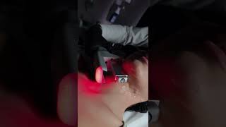 💉SMAS-лифтинг - современная методика безоперационного омоложения, альтернатива пластической операции