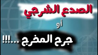 د.فيصل سرو     |     شرح مبسط.......  الصدع الشرجي أو جرح المخرج ️?