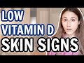 Skin SIGNS OF LOW VITAMIN D @Dr Dray