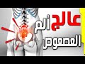 علاج ألم العصعص ومضاعفاته بنجاح ألم عظم الذنب اثناء الجلوس Coccydynia 