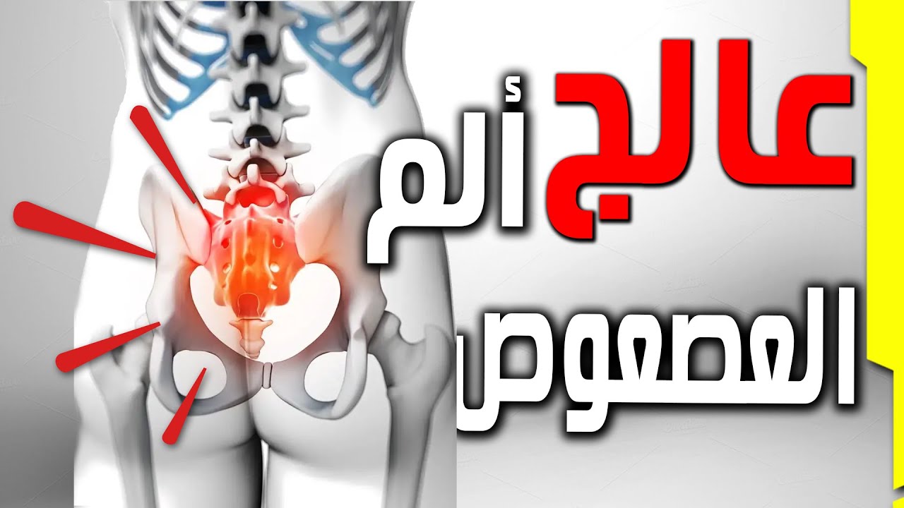 علاج ألم العصعص ومضاعفاته  بنجاح || ألم عظم الذنب اثناء الجلوس Coccydynia