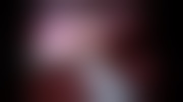 Robotic Cholangiogram