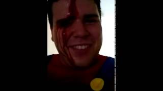 Super Marios Head Gash