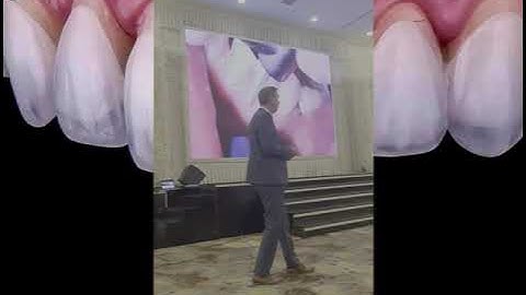 LỰA CHỌN MŨI KHOAN MÀI RĂNG SỨ VENEER